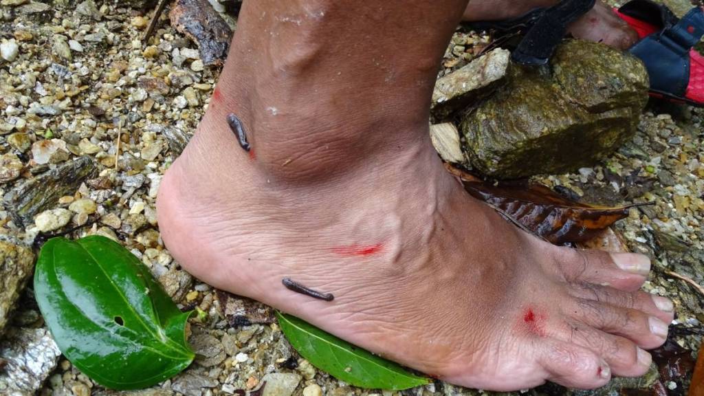 Two leeches attached to a bare foot and a few bleeding wounds from the removed leeches